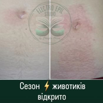 Фото с портфолио Олена Чайка