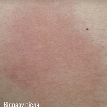 Фото с портфолио Олена Чайка