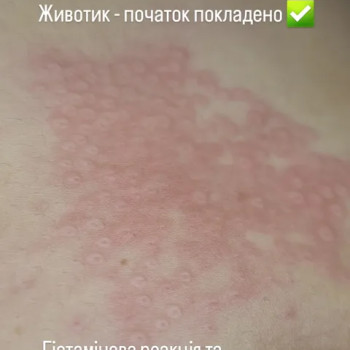 Фото с портфолио Олена Чайка