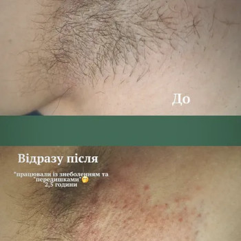 Фото с портфолио Олена Чайка