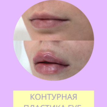 Фото с портфолио Неля Константиновна Яременко