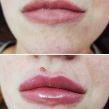 Фото с портфолио Наталія Колеснікова