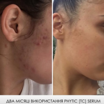 Фото с портфолио Альона Степаненко