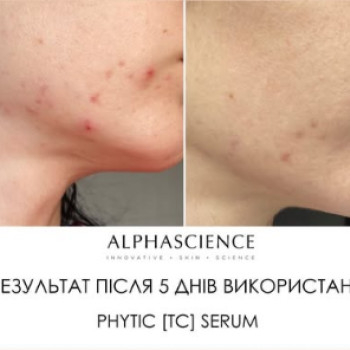 Фото с портфолио Альона Степаненко