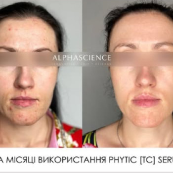 Фото с портфолио Альона Степаненко