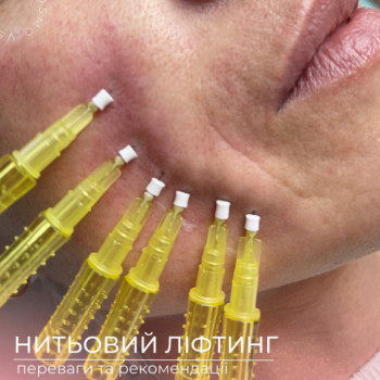 Фото с портфолио Ольга Сигорських