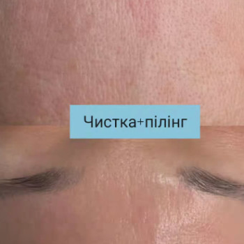Фото с портфолио Ольга Яхіна