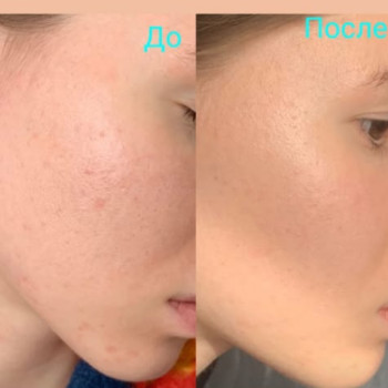 Фото с портфолио Тетяна Павлишена