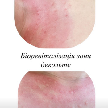 Фото с портфолио Liubov Bereza