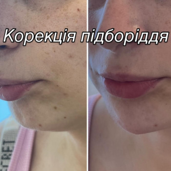 Фото с портфолио Наталия Книженко
