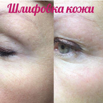 Фото с портфолио Тетяна Ткаченко