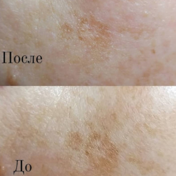 Фото с портфолио Тетяна Ткаченко