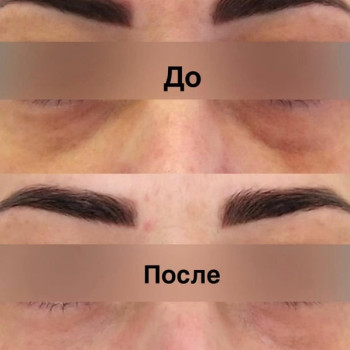Фото с портфолио Тетяна Ткаченко