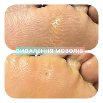 Фото с портфолио Ірина Абраменко