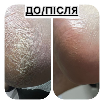 Фото с портфолио Ірина Абраменко