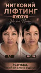 Спеціальна пропозиція на нитковий ліфтинг Cog Косметолог-инъекционист Любов Днепр