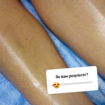 Фото с портфолио Віта Хровст