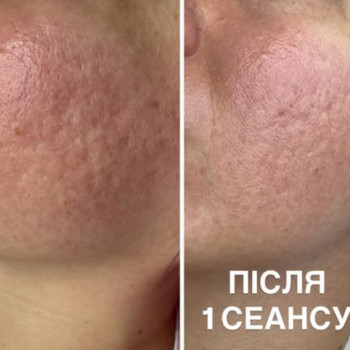 Фото с портфолио Аліна Фучеджи