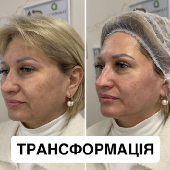 Фото с портфолио Аліна Фучеджи