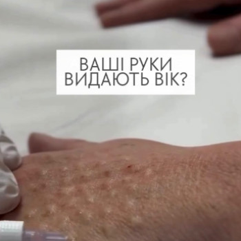 Фото с портфолио Аліна Фучеджи