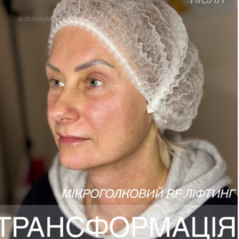 Фото с портфолио Аліна Фучеджи