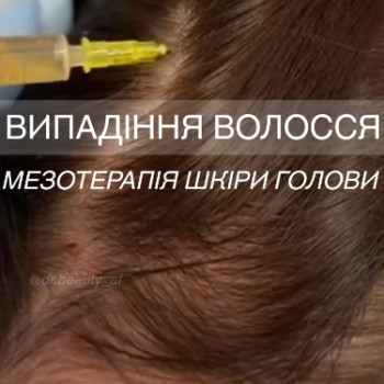 Фото с портфолио Аліна Фучеджи