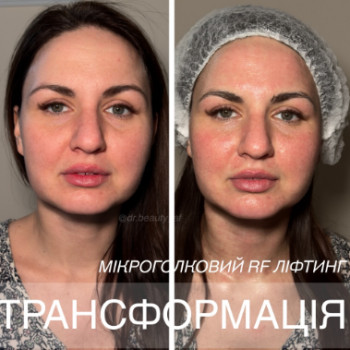 Фото с портфолио Аліна Фучеджи