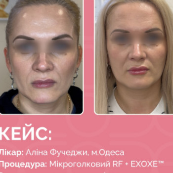 Фото с портфолио Аліна Фучеджи