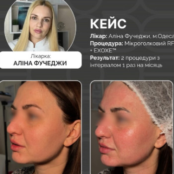 Фото с портфолио Аліна Фучеджи
