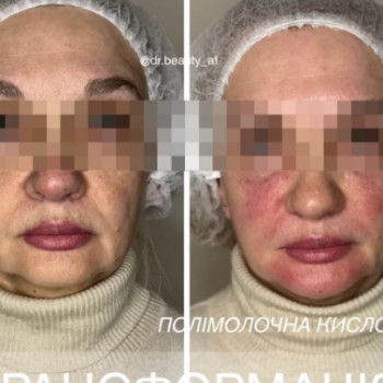 Фото с портфолио Аліна Фучеджи