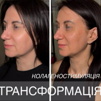 Фото с портфолио Аліна Фучеджи
