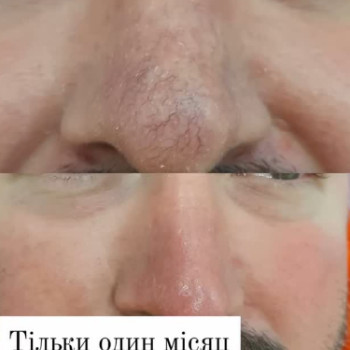 Фото с портфолио Светлана Валерьевна Толстоног