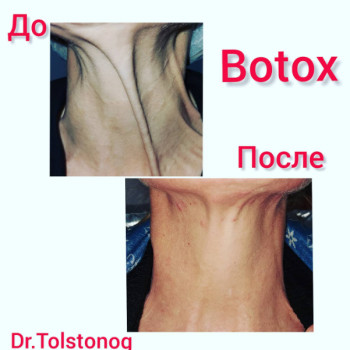 Фото с портфолио Светлана Валерьевна Толстоног