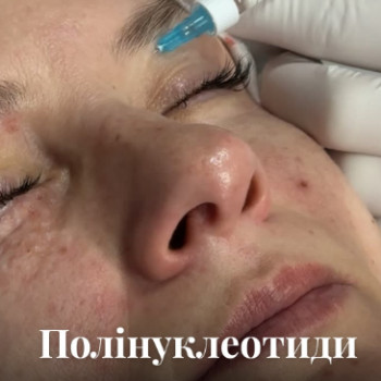 Фото с портфолио Оксана Татаєва