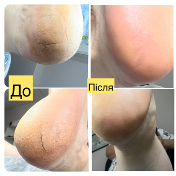 Фото с портфолио Ірина Абраменко