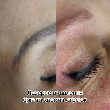 До та пiсля