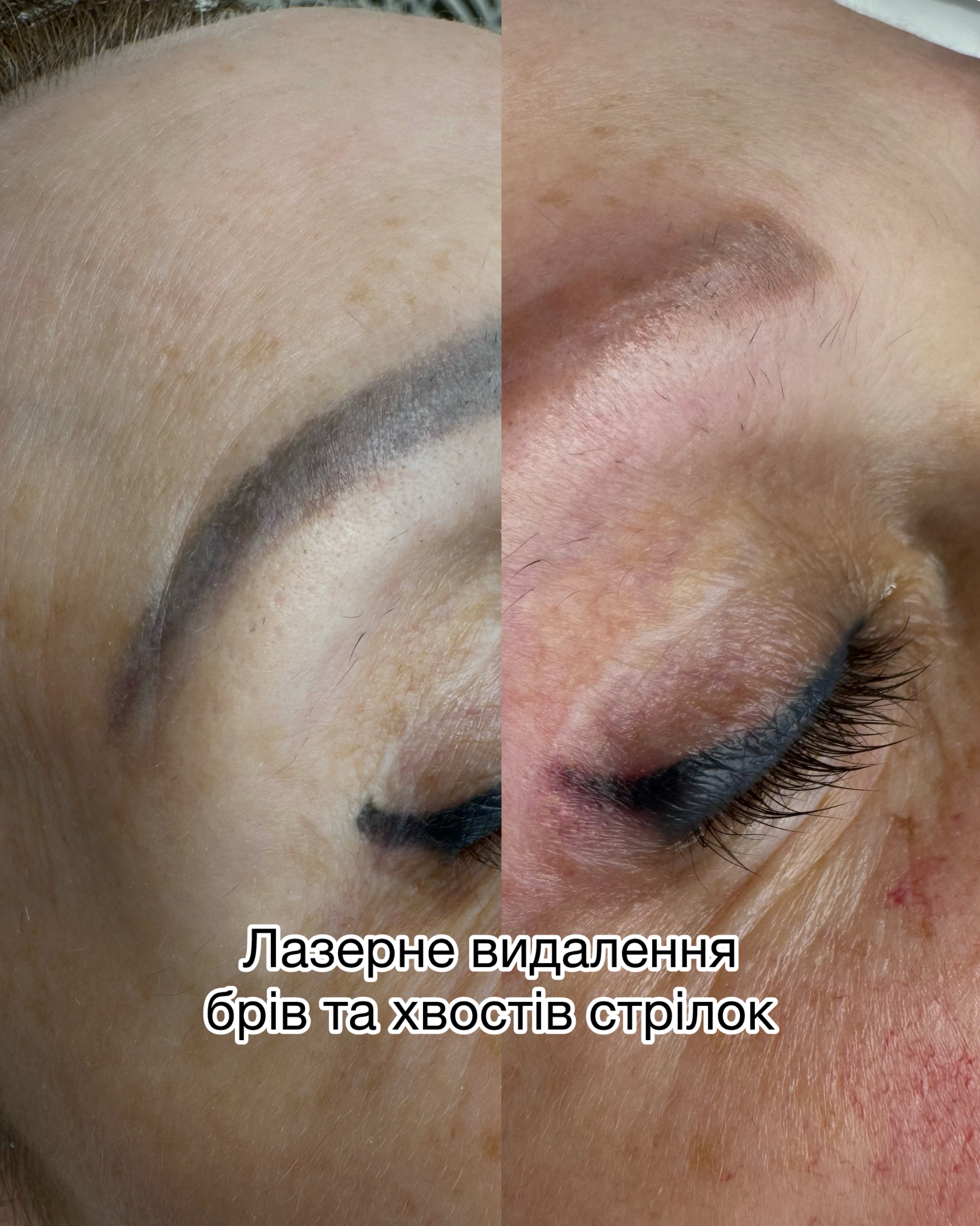До та пiсля, фото - Мастер татуажа Татьяна Латова