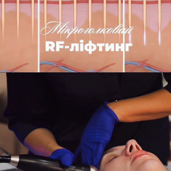 Фото с портфолио Клініка естетичної медицини Мирослави Новосільської