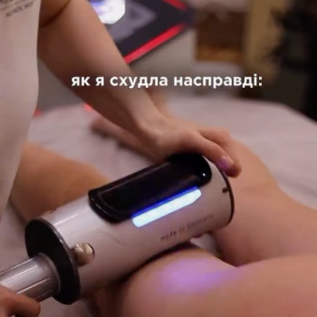 Фото с портфолио Клініка естетичної медицини Мирослави Новосільської