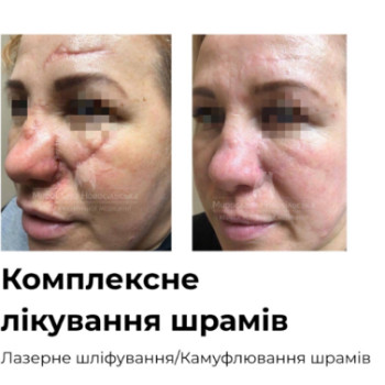 Фото с портфолио Клініка естетичної медицини Мирослави Новосільської