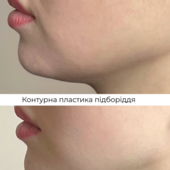 Фото с портфолио Клініка естетичної медицини Мирослави Новосільської