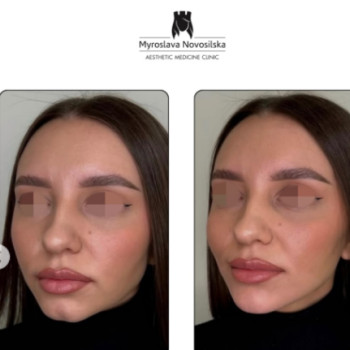 Фото с портфолио Клініка естетичної медицини Мирослави Новосільської