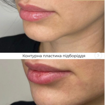Фото с портфолио Клініка естетичної медицини Мирослави Новосільської