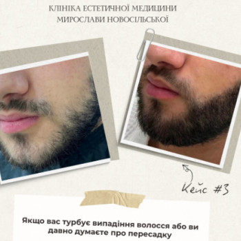 Фото с портфолио Клініка естетичної медицини Мирослави Новосільської