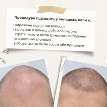 Фото с портфолио Клініка естетичної медицини Мирослави Новосільської
