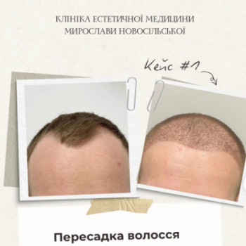 Фото с портфолио Клініка естетичної медицини Мирослави Новосільської