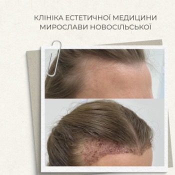 Фото с портфолио Клініка естетичної медицини Мирослави Новосільської