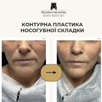 Фото с портфолио Клініка естетичної медицини Мирослави Новосільської