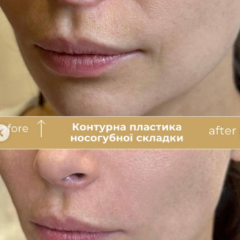 Фото с портфолио Клініка естетичної медицини Мирослави Новосільської