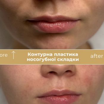 Фото с портфолио Клініка естетичної медицини Мирослави Новосільської